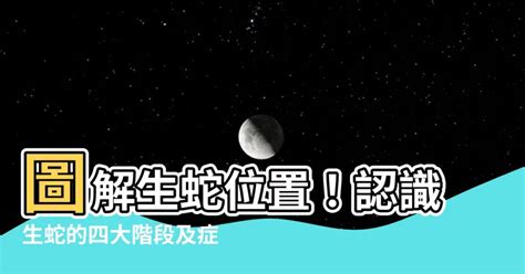 生蛇位置圖|生蛇病徵/階段/位置你要知｜生蛇止痛方法｜消費者委員